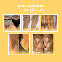 Lemon Turmeric & Kojic Acid Brightening Soap